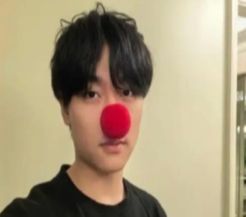 被误伤的川哥北川晒红鼻子喊话队友：SorryElkON